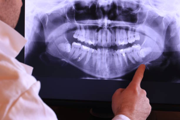 Best Emergency Dental Care for Broken or Chipped Teeth in Auburn, CA
