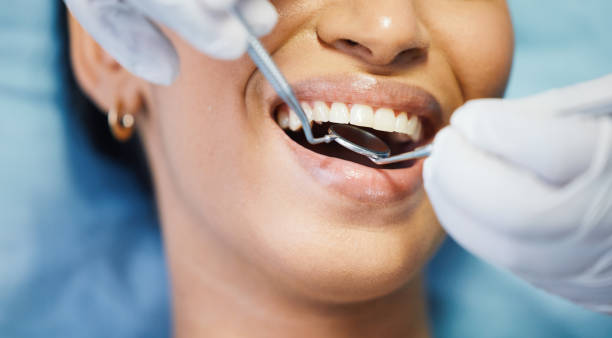 Best Same-Day Emergency Dental Services in Auburn, CA